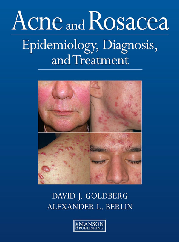 Acne and Rosacea textbook co-authored by Dr. Alexander Berlin